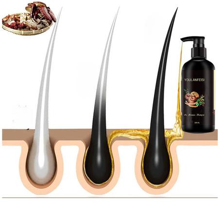 شامبو الزنجبيل الأسود  للتخلص من الشيب طبيعيا و بدون مواد كيميائية للرجال والنساء  .