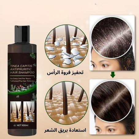 شامبو بيولوجي لإصلاح فروة الرأس، مضاد للقشرة وتساقط الشعر