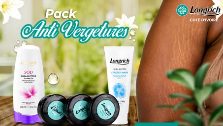 Kit anti-Vergetures