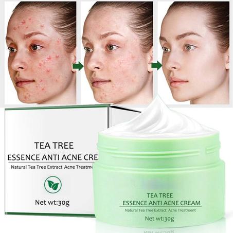 كريمة الشاي الطبيعي لعلاج حب شباب