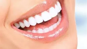 SNAP HOLLYWOOD SMILE 💫 ( ORIGINAL )