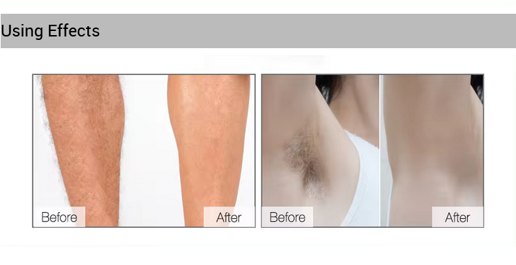 stores/7dbd495238adf15fffd11c247ea2f6b5/products/rou6d0V2B018aVRNqfmVqPzg3xwmoFkvVEU47FpL.png