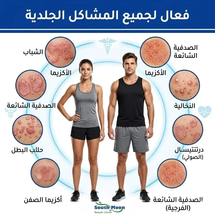 وداعاً لآلام الصدفية والحكة من الاستعمال الأول مع مرهم South Moon الأصلي الحل الطبيعي المتكامل لترميم البشرة واستعادة راحتك.