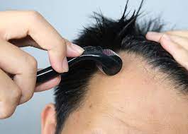 Derma roller