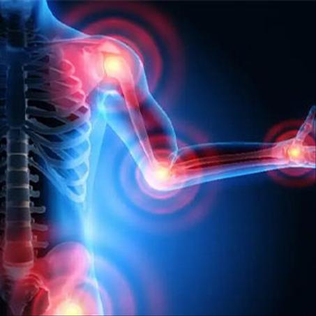 RHUMATISME , ARTICULATIONS