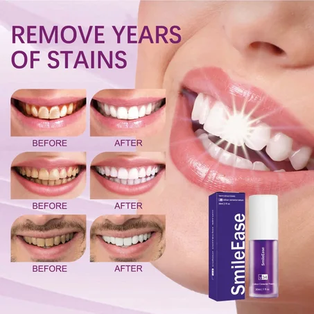 معجون الأسنان البنفسجي Hismile Oralcare