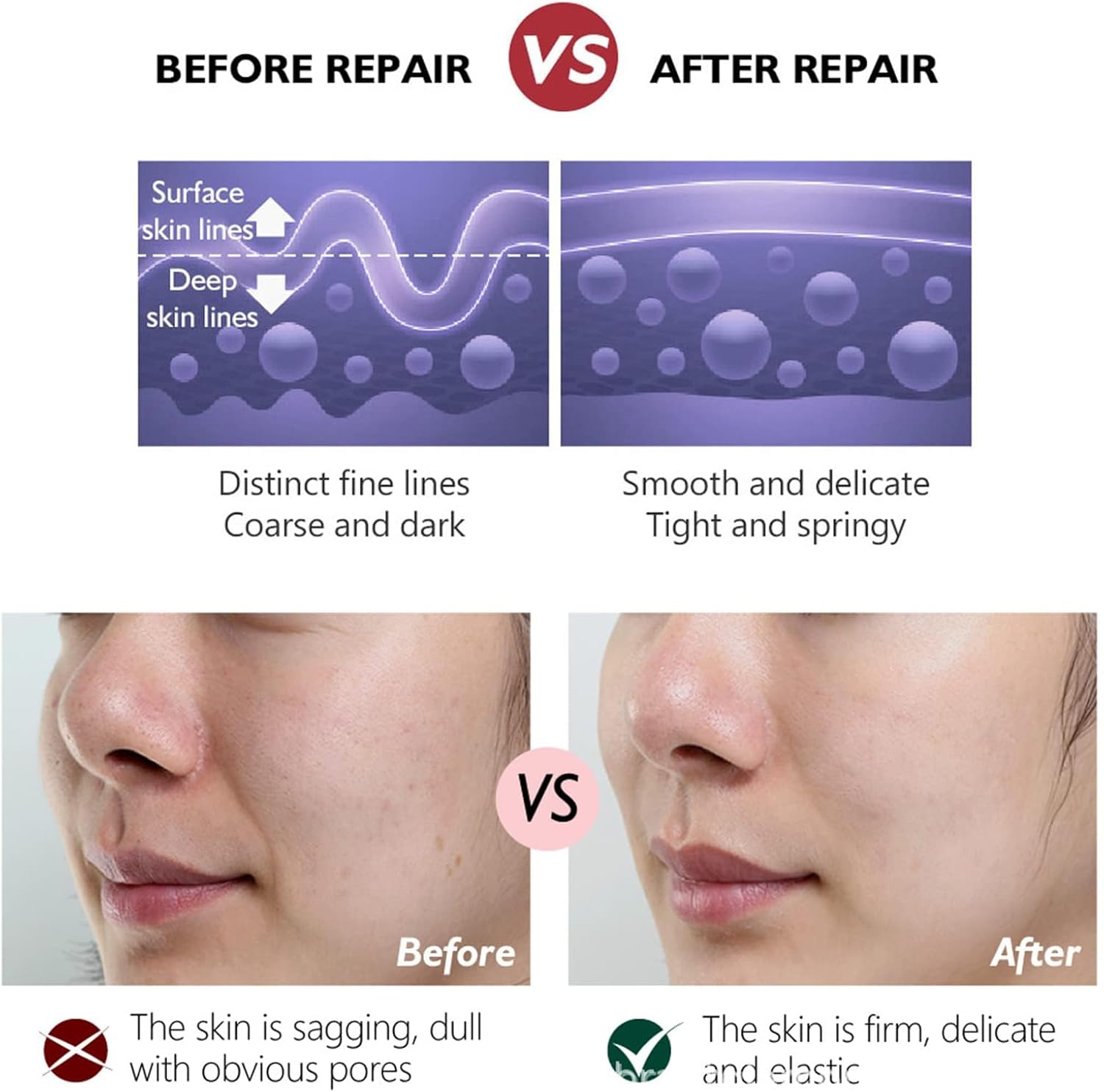 Anti Aging Retinol Cream