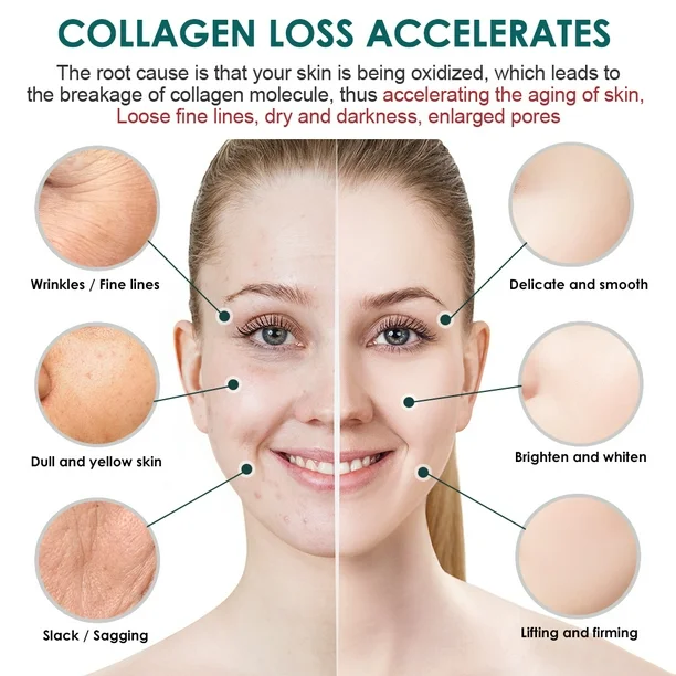 Anti Aging Retinol Cream