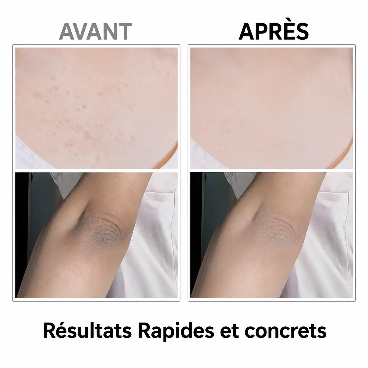 Peau Lisse & Éclatante en un Spray