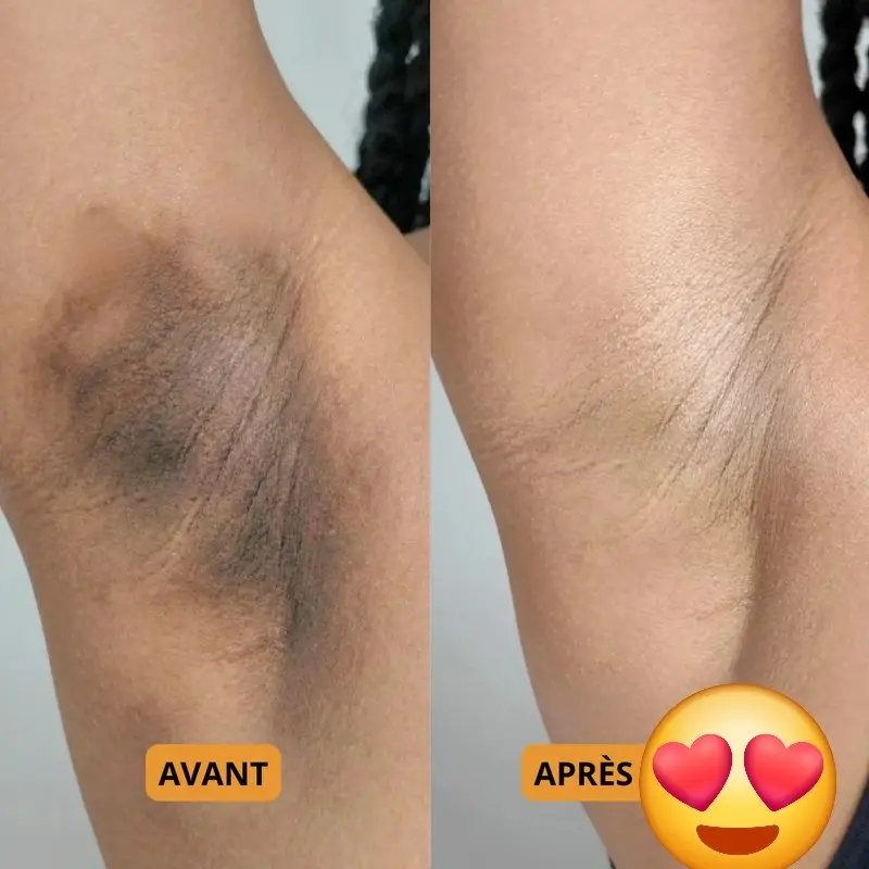 Peau Lisse & Éclatante en un Spray