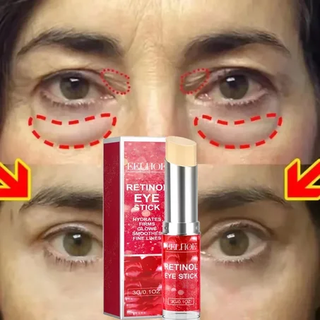 Retinol Anti-Wrinkle Eye