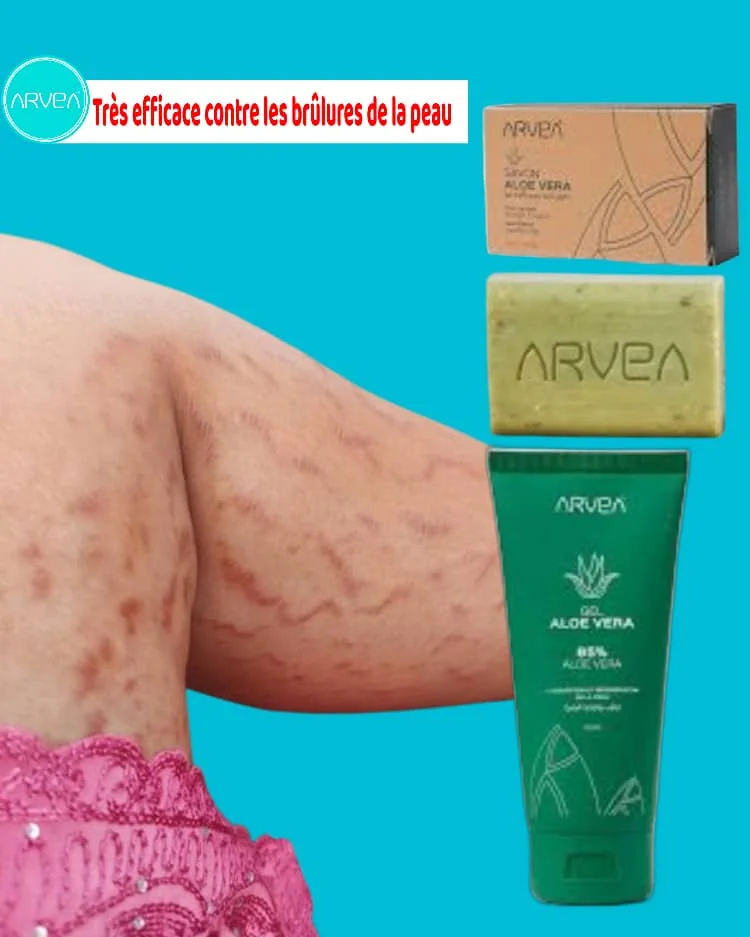 🌿 ARVEA ALOE VERA