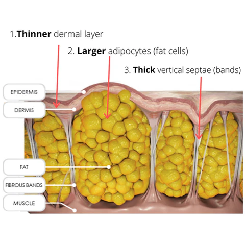 Oveallgo™ BEAUTIFIC Anti-Cellulite Firming Soap 21 Oveallgo™ BEAUTIFIC Anti-Cellulite Firming Soap