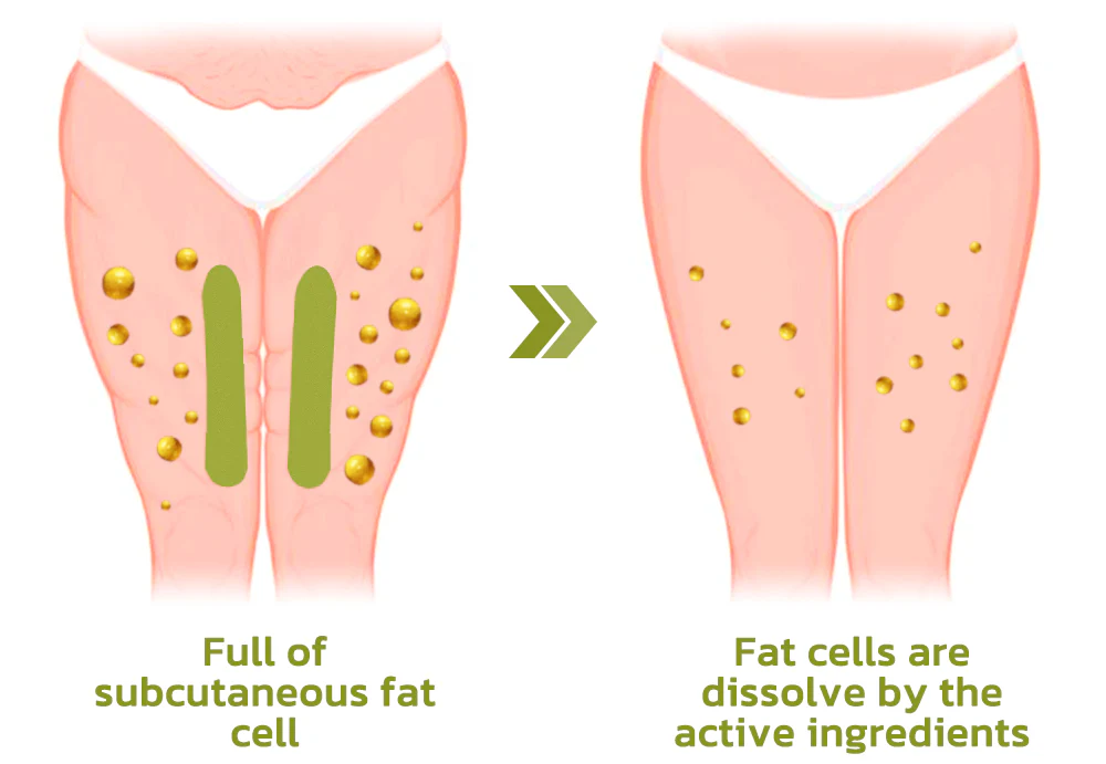 Patchs anti-cellulite HerbalLegs