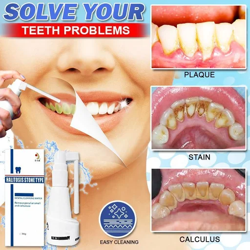 Tartar-free dissolving dental spray