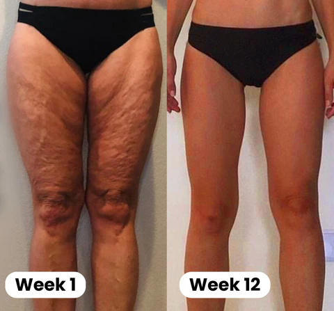 Oveallgo™ BEAUTIFIC Anti-Cellulite Firming Soap 19