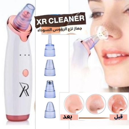 جهاز ازالة الرؤوس السوداء XR CLEANER