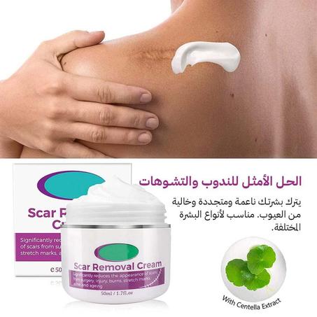 Magic scar removal cream