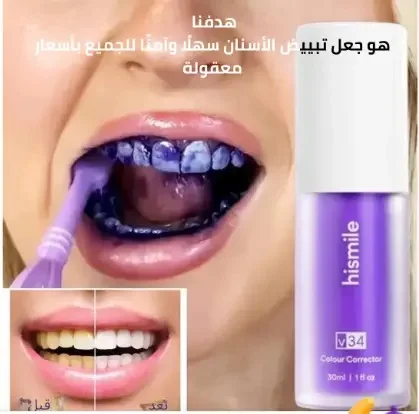 معجون الأسنان V34