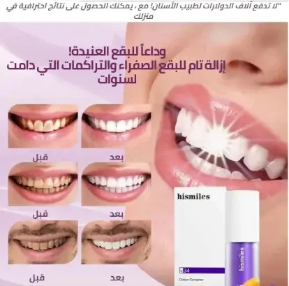 معجون الأسنان V34