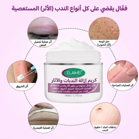 كريم إيلايمي (ELAIMEI) الأصلي لإزالة الندوب وآثار الحمل والجروح - سر البشرة النقية