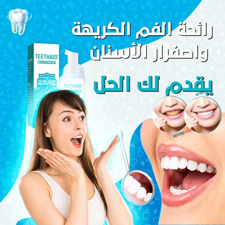 "إبتسم بثقة مع منتج تبييض الأسنان الأفضل,"احصل على إبتسامة مشرقة خلال 7 أيام!"