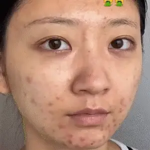 Whitening cream