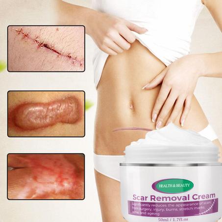 Magic scar removal cream  كريم إزالة الندبات