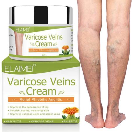 Varicose Veins Cream  كريم دوالي لتوسيع الأوردة