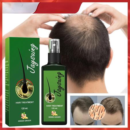 ضد تساقط الشعر