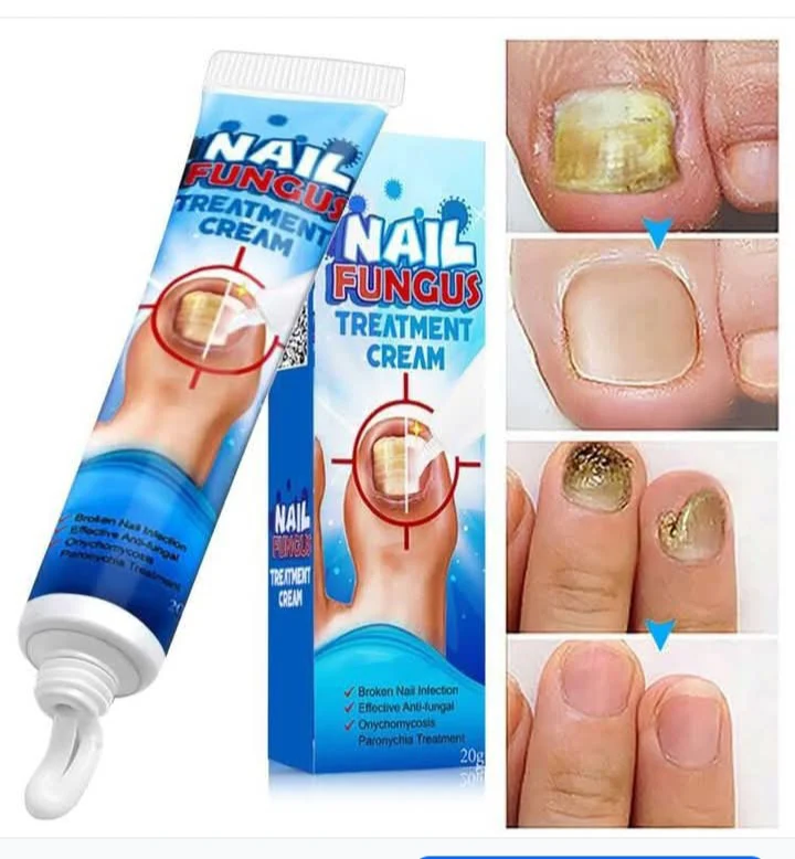 كريم للقضاء على فطريات الأظافر الأصلي