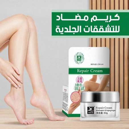 كريم مضاد للتشققات الجلدية