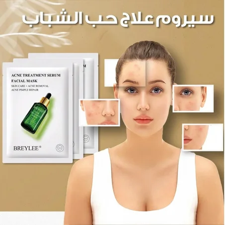 سيروم علاج حب الشباب