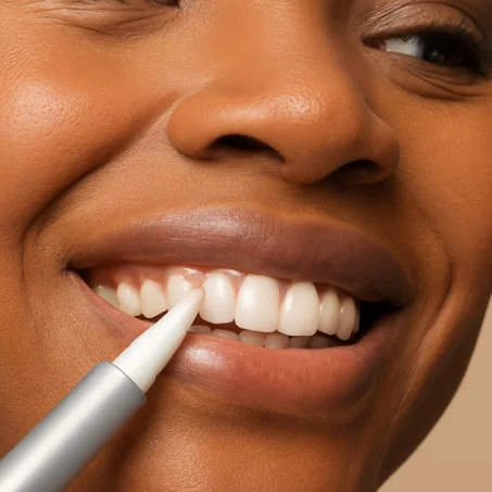 Blanchir vos dents en 7 jours  avec ce Stylo de blanchiment dentaire (+ 01 dentifrice offert)