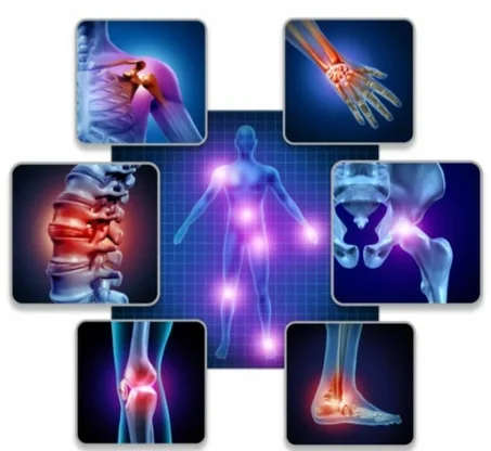 مجموعة الام المفاصل