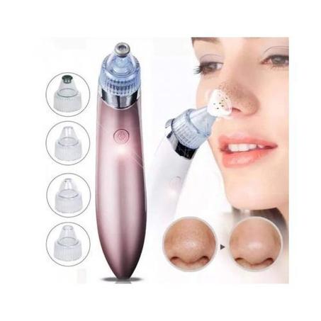 Aspirateur électrique visage pour les points noirs