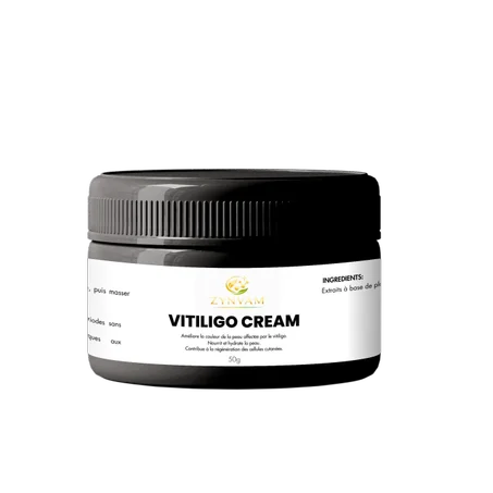 Vitiligo Créme