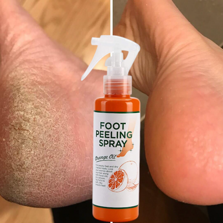"بخاخ تقشير القدم لعلاج التشققات مع كريم ترطيب البشرة – هدية مثالية لجمالكِ 💖👣"