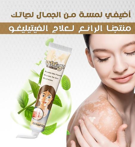 افضل كريم لعلاج البهاق