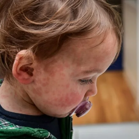Soins Apaisants & Anti-Rougeurs Bébés