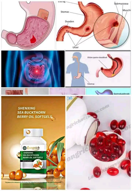 BERRY OIL DE LONGRICH