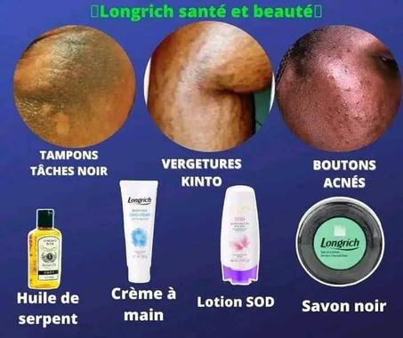 KIT CONTRE LES VERGETURES