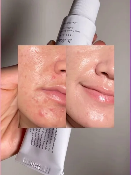 Dr. Althea 345 Relief Cream