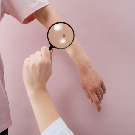 طرق علاج التصبغات الجلدية بسرعة