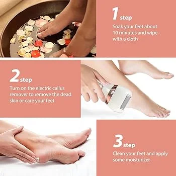 Tondeuse Électrique pour Pieds – Broyeur de Callosités Rechargeable USB