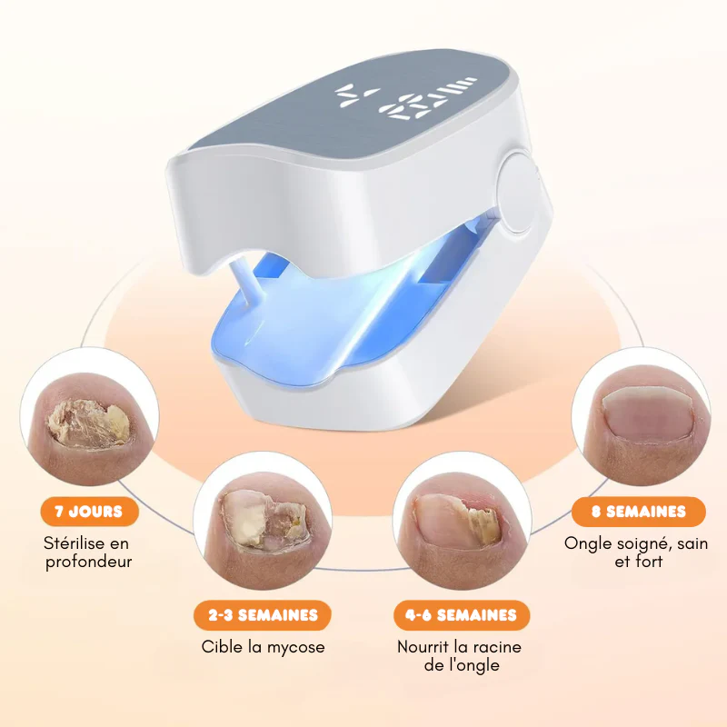 Appareil Anti-Mycose – Solution Complète pour Ongles et Peau
