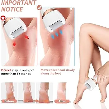 Tondeuse Électrique pour Pieds – Broyeur de Callosités Rechargeable USB