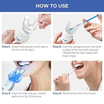 Kit de blanchiment des dents