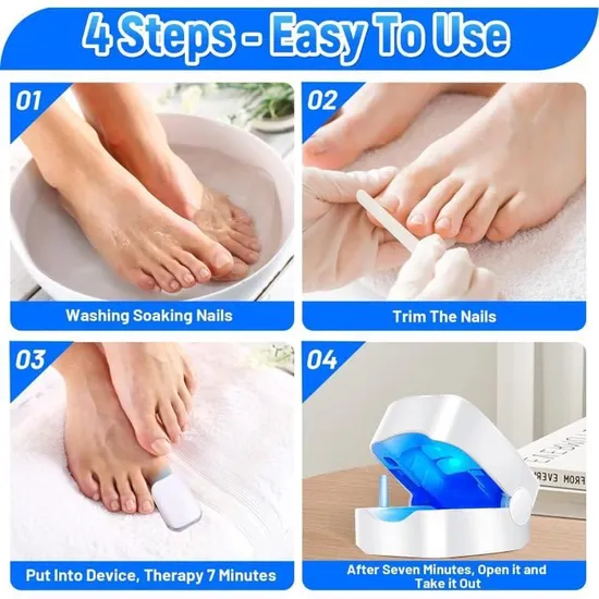 Appareil Anti-Mycose – Solution Complète pour Ongles et Peau