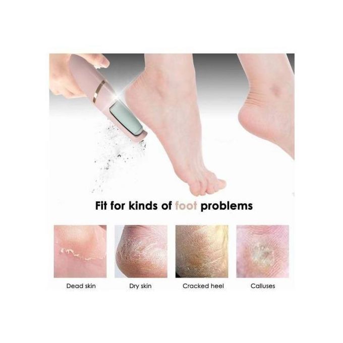 Foot File Dead Dry Skin Callus